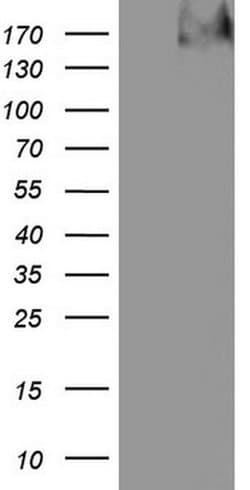 TG Monoclonal Antibody (OTI8F6), TrueMAB , OriGene 100 &mu;L | Buy Online | Origene Technologies | Fisher Scientific