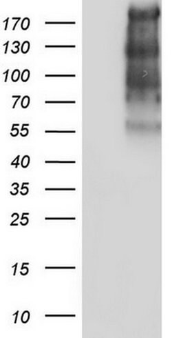 TG Monoclonal Antibody (OTI1F1), TrueMAB , OriGene 100 &mu;L; Unconjugated:Antibodies,