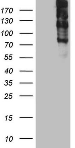 TG Monoclonal Antibody (OTI8A8), TrueMAB , OriGene 100 &mu;L; Unconjugated:Antibodies,