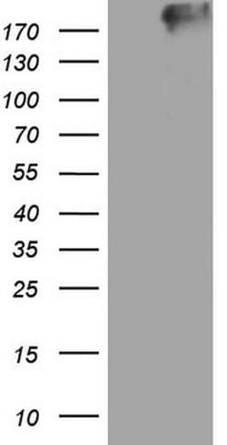 TG Monoclonal Antibody (OTI1G4), TrueMAB , OriGene 30 &mu;L; Unconjugated:Antibodies,