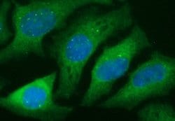 TGFB1 Mouse anti-Human, Clone: OTI3B6, lyophilized, TrueMAB 100 &mu;g | Buy Online | Origene Technologies | Fisher Scientific