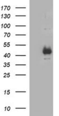 TGFB1 Mouse anti-Human, Clone: OTI3B6, lyophilized, TrueMAB 100 &mu;g | Buy Online | Origene Technologies | Fisher Scientific