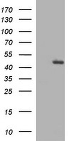 TGFB1 Monoclonal Antibody (OTI2B5), TrueMAB , OriGene 100 &mu;L | Buy Online | OriGene | Fisher Scientific
