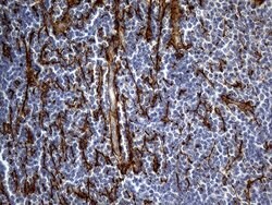 TGFBI Mouse anti-Human, Clone: OTI9A11, lyophilized, TrueMAB 100 &mu;g;