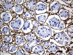 TGFBI Mouse anti-Human, Clone: OTI9A11, lyophilized, TrueMAB 100 &mu;g;