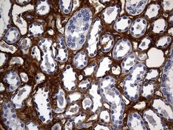 TGFBI Mouse anti-Human, Clone: OTI9A11, lyophilized, TrueMAB 100 &mu;g;