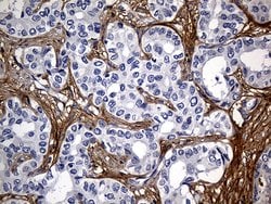 TGFBI Mouse anti-Human, Clone: OTI9A11, lyophilized, TrueMAB 100 &mu;g;