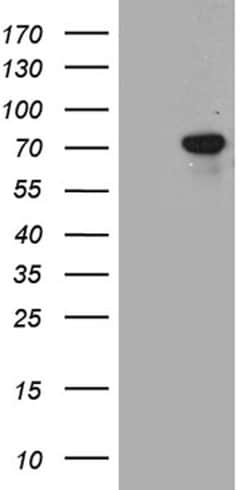 TGFBI Mouse anti-Human, Clone: OTI9A11, lyophilized, TrueMAB 100 &mu;g;