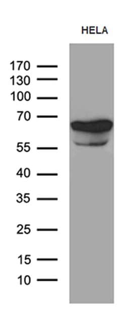 TGFBI Mouse anti-Human, Clone: OTI9A11, lyophilized, TrueMAB 100 &mu;g;