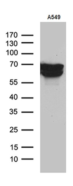 TGFBI Mouse anti-Human, Clone: OTI9A11, lyophilized, TrueMAB 100 &mu;g;