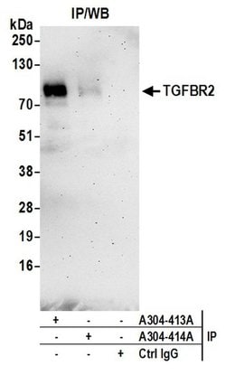 TGFBR2 Rabbit anti-Human, Polyclonal, Bethyl Laboratories 100 &mu;L; Unconjugated:Antibodies,