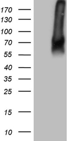 TGFBR2 Mouse anti-Human, Clone: OTI4F3, lyophilized, TrueMAB 100 &mu;g | Buy Online | Origene Technologies | Fisher Scientific