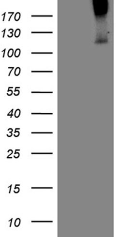 TGFBR3 Mouse anti-Human, Clone: OTI6B2, lyophilized, TrueMAB 100 &mu;g;