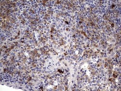 TGIF1 Monoclonal Antibody (OTI1A6), TrueMAB , OriGene 100 &mu;L; Unconjugated:Antibodies,