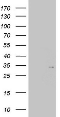 TGIF1 Mouse anti-Human, Clone: OTI1A6, lyophilized, TrueMAB 100 &mu;g;