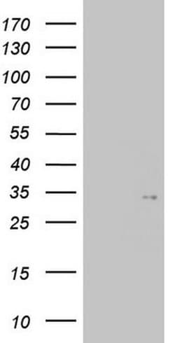 TGIF1 Monoclonal Antibody (OTI1A6), TrueMAB , OriGene 100 &mu;L; Unconjugated:Antibodies,