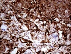 TGM2 Monoclonal Antibody (OTI2F9), TrueMAB , OriGene 100 &mu;L; Unconjugated:Antibodies,