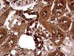 TGM2 Monoclonal Antibody (OTI2F9), TrueMAB , OriGene:Antibodies:Primary