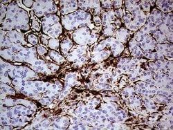TGM2 Monoclonal Antibody (OTI1A3), TrueMAB , OriGene:Antibodies:Primary