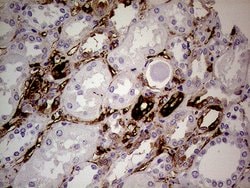 TGM2 Monoclonal Antibody (OTI1A3), TrueMAB , OriGene:Antibodies:Primary