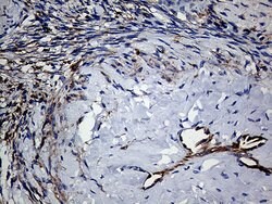 TGM2 Monoclonal Antibody (OTI4H5), TrueMAB , OriGene 100 &mu;L; Unconjugated:Antibodies,