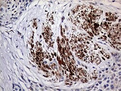 TGM2 Monoclonal Antibody (OTI4H5), TrueMAB , OriGene:Antibodies:Primary