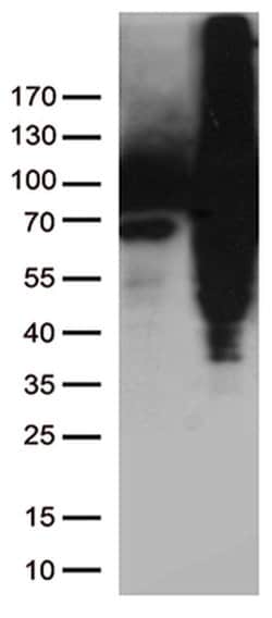 TGM2 Monoclonal Antibody (OTI2F9), TrueMAB , OriGene:Antibodies:Primary