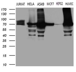 TGM2 Monoclonal Antibody (OTI2F9), TrueMAB , OriGene 100 &mu;L; Unconjugated:Antibodies,