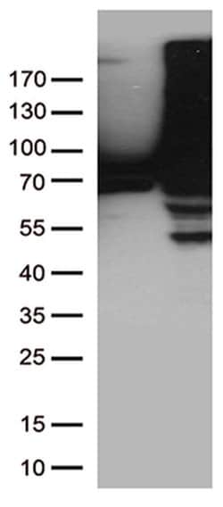 TGM2 Monoclonal Antibody (OTI1A3), TrueMAB , OriGene 100 &mu;L; Unconjugated:Antibodies,