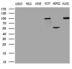 TGM2 Monoclonal Antibody (OTI1A3), TrueMAB , OriGene 100 &mu;L; Unconjugated:Antibodies,