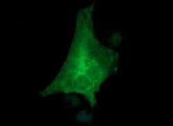 TH Monoclonal Antibody (OTI1A12), TrueMAB , OriGene 100 &mu;L; Unconjugated:Antibodies,