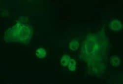 TH Monoclonal Antibody (OTI3H3), TrueMAB , OriGene 100 &mu;L; Unconjugated:Antibodies,