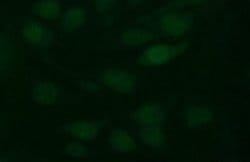 TH Mouse anti-Human, Mouse, Clone: OTI3H3, lyophilized, TrueMAB 100 &mu;g;