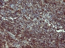TH Monoclonal Antibody (OTI1A12), TrueMAB , OriGene:Antibodies:Primary
