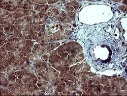 TH Monoclonal Antibody (OTI2E5), TrueMAB , OriGene 100 &mu;L; Unconjugated:Antibodies,