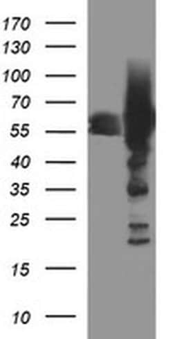 TH Monoclonal Antibody (OTI1A12), TrueMAB , OriGene 100 &mu;L; Unconjugated:Antibodies,