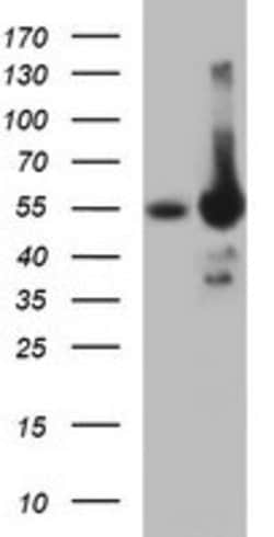 TH Mouse anti-Human, Mouse, Clone: OTI3H3, lyophilized, TrueMAB 100 &mu;g;