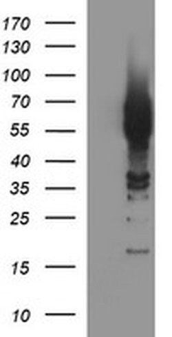 TH Monoclonal Antibody (OTI2E5), TrueMAB , OriGene:Antibodies:Primary Antibodies