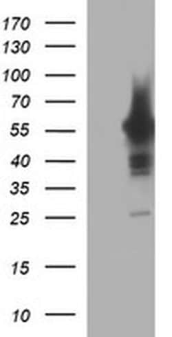 TH Mouse anti-Human, Clone: OTI3G3, liquid, TrueMAB 100 &mu;L; Unconjugated:Antibodies,
