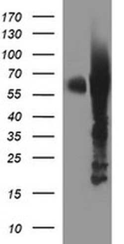 TH Monoclonal Antibody (OTI2D4), TrueMAB , OriGene 30 &mu;L; Unconjugated:Anticuerpos