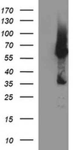 TH Monoclonal Antibody (OTI1A4), TrueMAB , OriGene 100 &mu;L; Unconjugated:Antibodies,