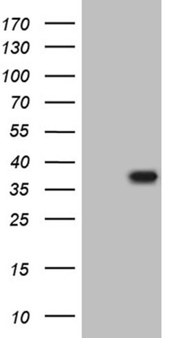 THAP5 Monoclonal Antibody (OTI2D7), TrueMAB , OriGene 100 &mu;L | Buy Online | Origene Technologies | Fisher Scientific