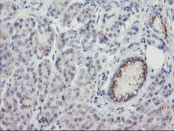 THAP6 Monoclonal Antibody (OTI1F6), TrueMAB , OriGene:Antibodies:Primary