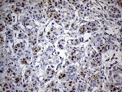 THAP8 Mouse anti-Human, Clone: OTI5D11, lyophilized, TrueMAB 100 &mu;g;