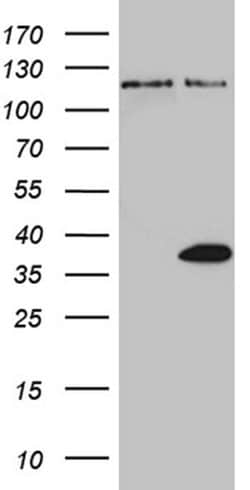THAP8 Monoclonal Antibody (OTI4F7), TrueMAB , OriGene:Antibodies:Primary