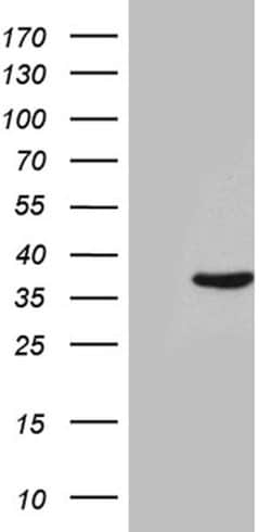 THAP8 Mouse anti-Human, Clone: OTI5A1, lyophilized, TrueMAB 100 &mu;g | Buy Online | OriGene | Fisher Scientific