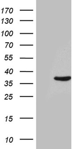 THAP8 Monoclonal Antibody (OTI5A1), TrueMAB , OriGene 100 &mu;L; Unconjugated:Antibodies,