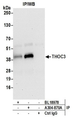 THOC3 Rabbit anti-Human, Mouse, Polyclonal, Bethyl Laboratories 100 &mu;L | Buy Online | Bethyl Laboratories, Inc | Fisher Scientific