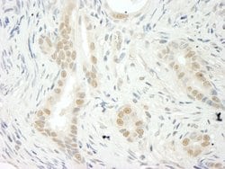 THOC5 Polyclonal Antibody, Bethyl Laboratories 10 &mu;L; Unconjugated:Antibodies,