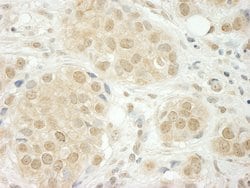 THOC5 Polyclonal Antibody, Bethyl Laboratories 10 &mu;L; Unconjugated:Antibodies,